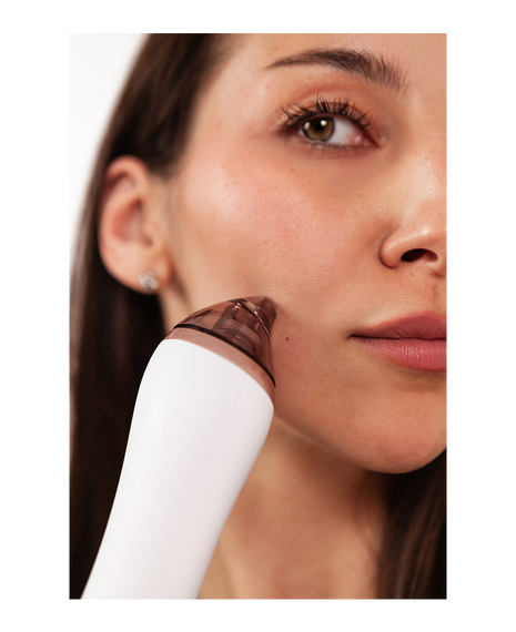 Microdermabrasion Handset