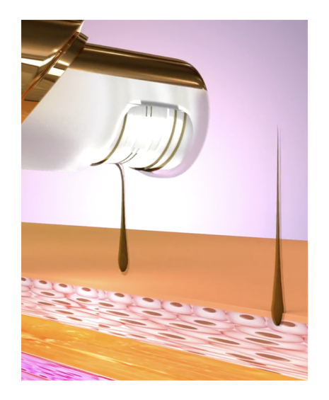 Velform Epilwiz Precision Epilator